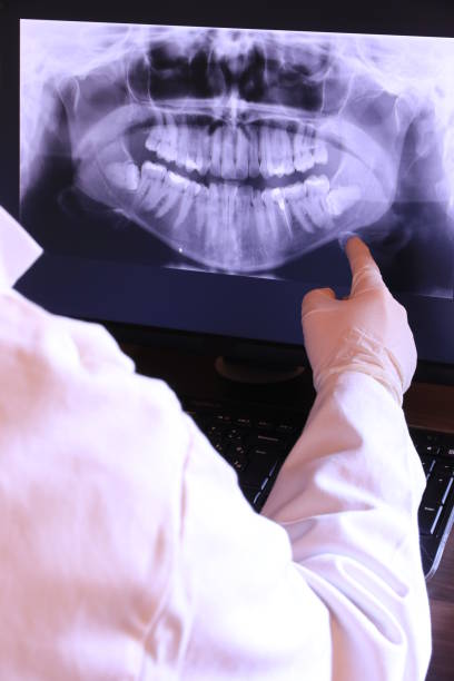 Best Emergency Treatment for Dental Infections or Abscesses in Attica, MI